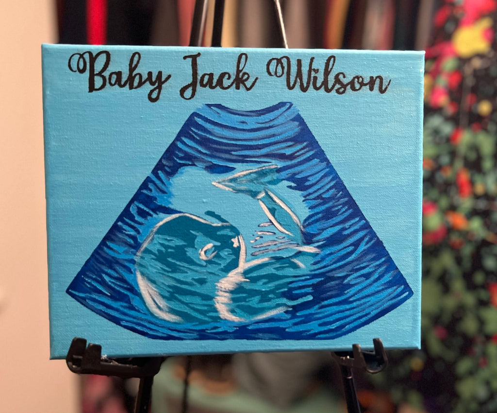 Custom Hand-Painted Ultrasound Portrait